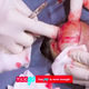 Image for article titled Bada Bing, Dr. Pimple Popper Meets Bada Boob
